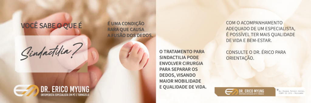 Descubra tudo sobre a sindactilia nos pés, suas causas, opções de tratamento e como o Dr. Érico pode ajudar você a recuperar mobilidade e conforto